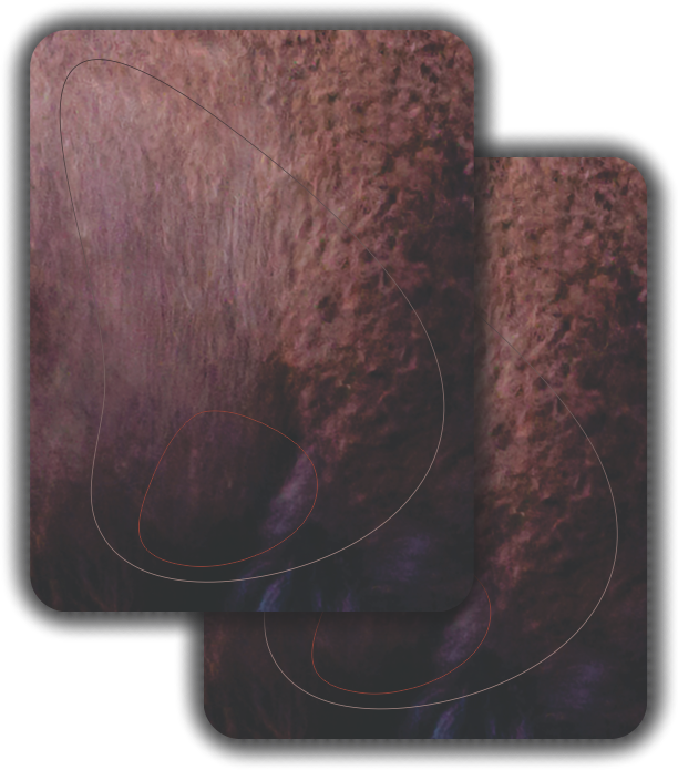 2D Mike Bison Broadside Vital Zones